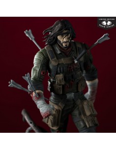 B -Limited Edition- 1/10.... 2